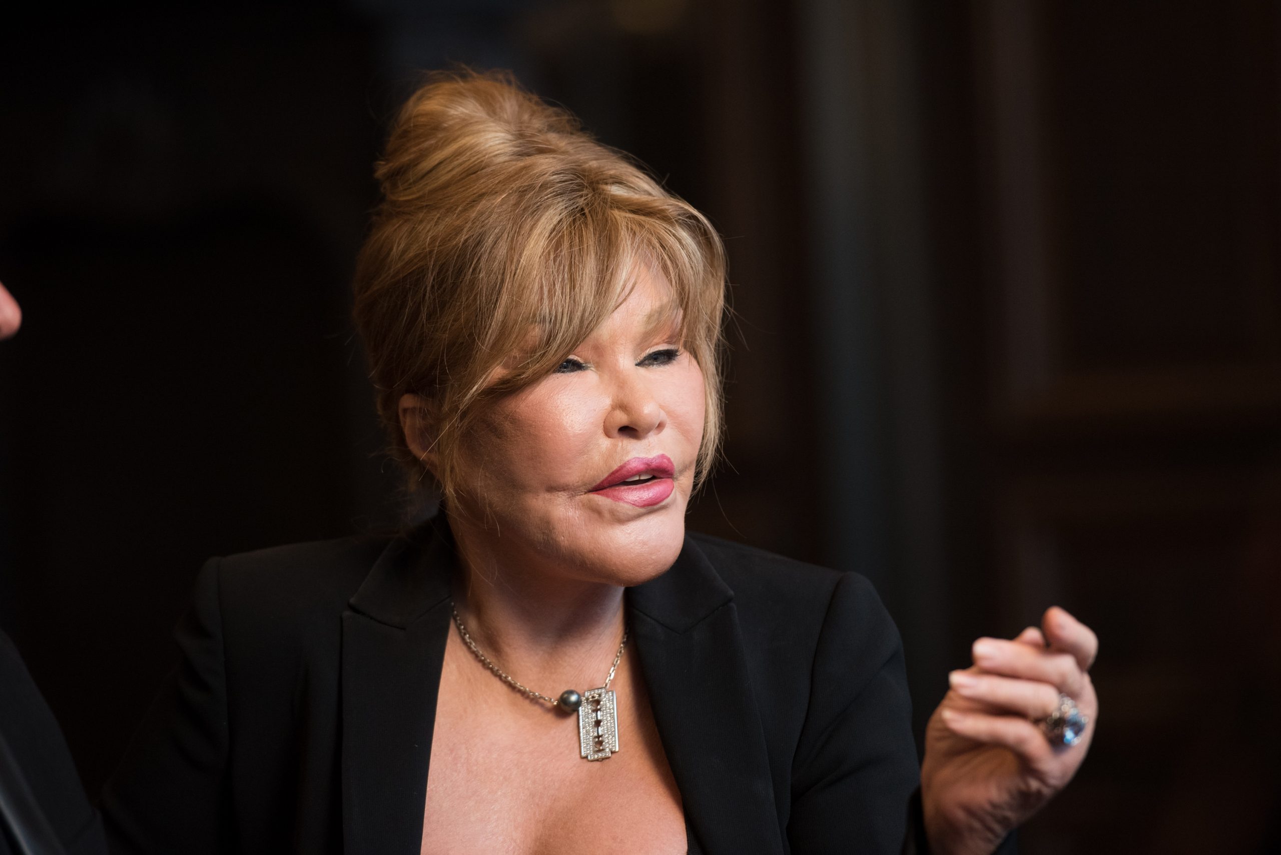 Jocelyn Wildenstein: Η ζωή, η μεταμόρφωση και ο θάνατος της «Catwoman» που πέθανε στα 84 χρόνια