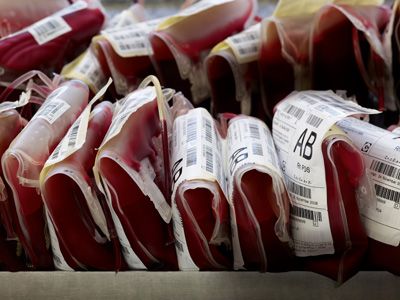 Σοβαρές ελλείψεις αίματος στις Μονάδες Μεσογειακής Αναιμίας