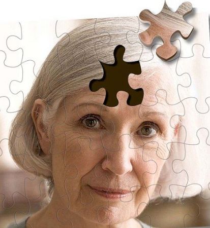 Βηματοδότης εγκεφάλου ίσως επιβραδύνει τη νόσο Αλτσχάιμερ