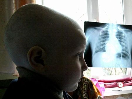 Έρευνα: Δεν χορηγείται θεραπεία στα μισά καρκινοπαθή παιδιά