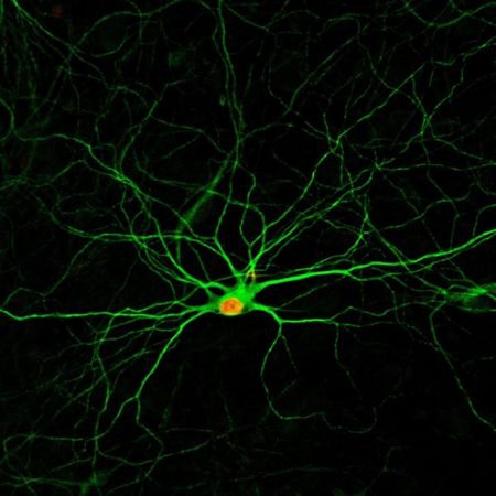 «Χάπι» θα αναγεννά νευρώνες στον εγκέφαλο