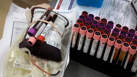 Έρευνα: Οι μεταγγίσεις αίματος είναι ασφαλείς από τον κορωνοϊό