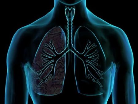 Σχέδιο έγκαιρης διάγνωσης καρκίνου πνεύμονα μελετά το υπουργείο Υγείας