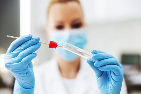 Ευλογιά των πιθήκων: Κούρσα για την ανάπτυξη rapid και PCR test