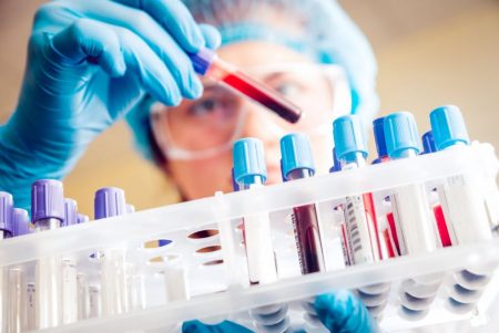 Καρκίνος: Διαγνωστικό «όπλο» οι απλές εξετάσεις αίματος – Η έρευνα