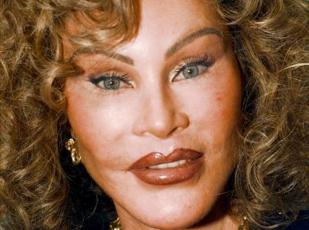 Ποια ήταν η Jocelyn Wildenstein: Η μεταμόρφωση σε «Catwoman» και το πολυσυζητημένο διαζύγιο