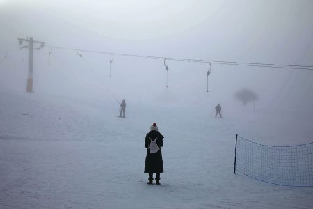 Εμφυτη αγένεια